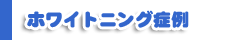 ホワイトニング症例
