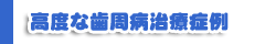 高度的な歯周病治療症例