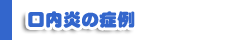 口内炎の症例